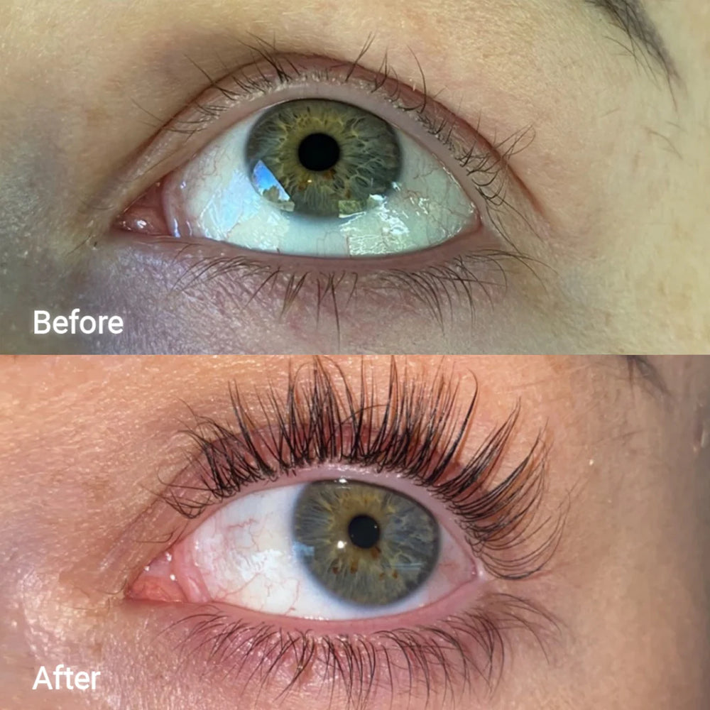 Advanced Lash & Brow Enhancing Serum (100% Effective)