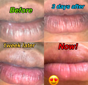 Permanent Pink Lips Balm (100% Effective)